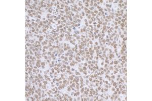 Immunohistochemistry (IHC) image for anti-Breast Carcinoma Amplified Sequence 2 (BCAS2) (C-Term) antibody (ABIN7453423) (BCAS2 Antikörper  (C-Term))