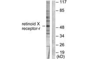 Western blot analysis of extracts from HepG2 cells, using Retinoid X Receptor gamma Antibody.