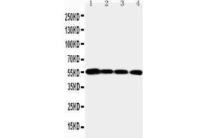 Anti-MMP24 antibody, Western blotting Lane 1: PANC Cell Lysate Lane 2: HELA Cell Lysate Lane 3: SMMC Cell Lysate Lane 4: A549 Cell Lysate