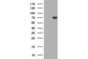 Image no. 6 for anti-Tumor Necrosis Factor Receptor Superfamily, Member 8 (TNFRSF8) (AA 19-379) antibody (ABIN1491087)