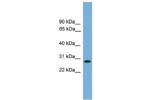 Human Jurkat; WB Suggested Anti-APOLD1 Antibody Titration: 0. (APOLD1 Antikörper  (Middle Region))