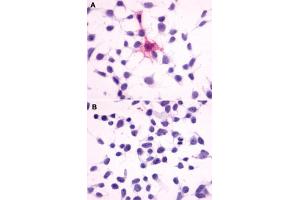 Immunocytochemistry (ICC) staining of HEK293 human embryonic kidney cells transfected (A) or untransfected (B) with MC4R. (MC4R Antikörper  (Extracellular Domain))