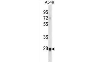 Western Blotting (WB) image for anti-Ras-Like Without CAAX 2 (RIT2) antibody (ABIN2998826)