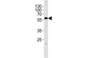 Western blot analysis of lysate from mouse testis tissue lysate using PHF1 antibody at 1:1000. (PHF1 Antikörper  (N-Term))