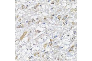 Immunohistochemistry of paraffin-embedded rat brain using SPICE1 antibody at dilution of 1:100 (x40 lens). (SPICE1 Antikörper)