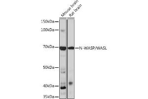 Western blot analysis of extracts of various cell lines, using N-WASP/N-WASP/WASL Rabbit mAb (ABIN7268856) at 1:1000 dilution. (Neural Wiskott-Aldrich syndrome protein (WASL) Antikörper)