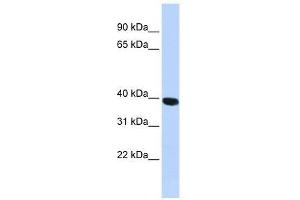 Western Blot showing HYAL1 antibody used at a concentration of 1.