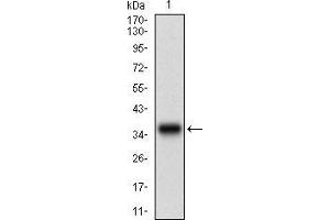 Western blot analysis using CSNK2B mAb against human CSNK2B (AA: FULL(1-215)) recombinant protein. (CSNK2B Antikörper  (AA 1-215))