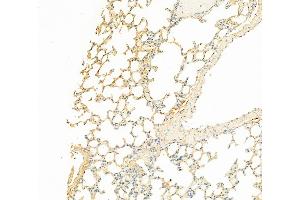 ABIN6261536 and ABIN6266485 at 1/100 staining Mouse lung tissue by IHC-P. (ENOS Antikörper  (C-Term))