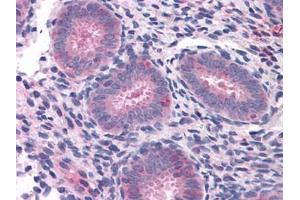 Human Uterus: Formalin-Fixed, Paraffin-Embedded (FFPE) (ELP3/KAT9 Antikörper)