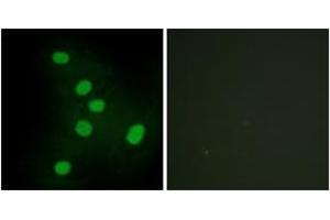 Immunofluorescence analysis of HepG2 cells, using NR2F6 Antibody. (NR2F6 Antikörper  (AA 11-60))