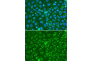 Immunofluorescence analysis of A549 cell using SRGN antibody. (SRGN Antikörper)