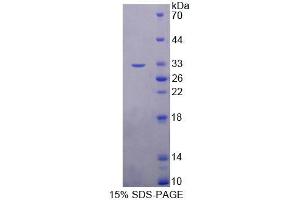 SDS-PAGE analysis of Human TOP3b Protein. (TOP3B Protein)
