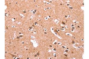 The image on the left is immunohistochemistry of paraffin-embedded Human brain tissue using ABIN7190731(GABRA1 Antibody) at dilution 1/30, on the right is treated with synthetic peptide. (GABRA1 Antikörper)