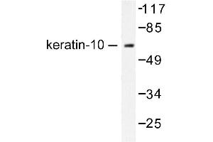 Image no. 1 for anti-Keratin 10 (KRT10) antibody (ABIN265492)
