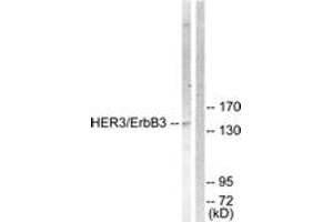 Western blot analysis of extracts from 293 cells, treated with LiCl 0. (ERBB3 Antikörper  (AA 1256-1305))