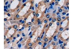 Immunohistochemistry (IHC) image for anti-Fatty Acid Binding Protein 1, Liver (FABP1) (AA 1-127) antibody (ABIN7441892)