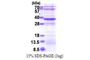 SDS-PAGE (SDS) image for NAD(P) Dependent Steroid Dehydrogenase-Like (NSDHL) (AA 1-297) protein (His tag) (ABIN6387344)