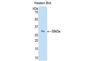 Western Blotting (WB) image for anti-Complement Factor D (CFD) (AA 1-259) antibody (ABIN3205986) (Adipsin Antikörper  (AA 1-259))