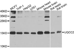 Western blot analysis of extracts of various cell lines, using UQCC2 antibody. (MNF1 Antikörper)