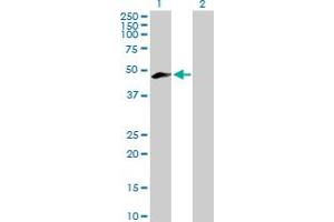 Western Blot analysis of MEIS3 expression in transfected 293T cell line by MEIS3 MaxPab polyclonal antibody. (MEIS3 Antikörper  (AA 1-421))