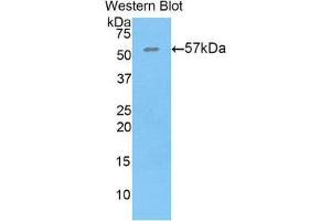 Western Blotting (WB) image for anti-Thrombospondin 4 (THBS4) (AA 662-923) antibody (ABIN1860747)