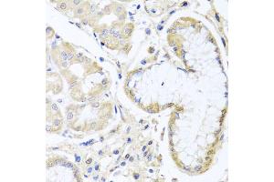 Immunohistochemistry of paraffin-embedded human stomach using INPP5K antibody (ABIN5975191) at dilution of 1/100 (40x lens). (INPP5K Antikörper)