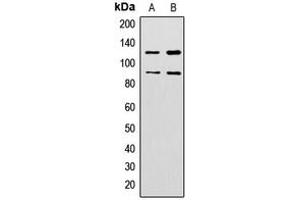 Western blot analysis of ZNF148 expression in HeLa (A), HepG2 (B) whole cell lysates.