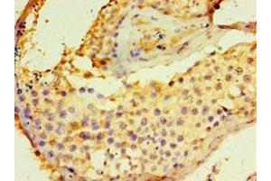 Immunohistochemistry of paraffin-embedded human testis tissue using ABIN7149845 at dilution of 1:100