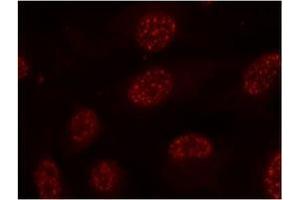 Image no. 1 for anti-Mitogen-Activated Protein Kinase-Activated Protein Kinase 2 (MAPKAPK2) (pThr334) antibody (ABIN197079) (MAPKAP Kinase 2 Antikörper  (pThr334))