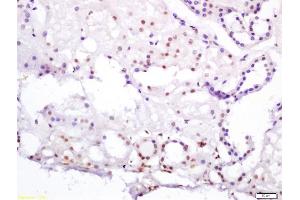 Formalin-fixed and paraffin embedded human kidney labeled with Anti-HNF4/TCF4/HNF4A Polyclonal Antibody, Unconjugated (ABIN704711) at 1:200 followed by conjugation to the secondary antibody and DAB staining (HNF4A Antikörper  (AA 301-400))