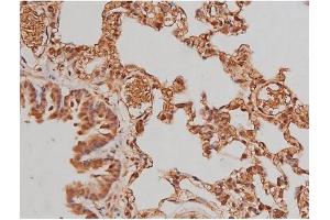 ABIN6267363 at 1/200 staining Rat lung tissue sections by IHC-P.