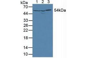 Figure. (DLD Antikörper  (AA 45-271))