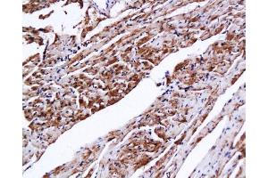 Immunohistochemistry (Paraffin-embedded Sections) (IHC (p)) image for anti-Cardiac Troponin C (TNNC1) (AA 131-210) antibody (ABIN728308)