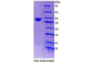 SDS-PAGE (SDS) image for Aurora Kinase C (AURKC) (AA 5-237) protein (His tag) (ABIN6238755) (Aurora Kinase C Protein (AURKC) (AA 5-237) (His tag))