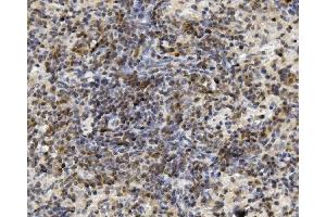 IHC analysis of U2AF2 using anti-U2AF2 antibody (ABIN7600793).