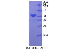 SDS-PAGE analysis of Rat BST1 Protein. (BST1 Protein)
