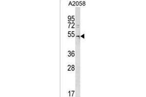 DCAF12L2 Antibody (C-term) (ABIN1537112 and ABIN2850214) western blot analysis in  cell line lysates (35 μg/lane). (DCAF12L2 Antikörper  (C-Term))