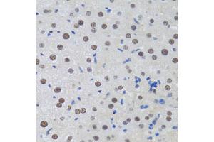 Immunohistochemistry of paraffin-embedded rat liver using MTA3 antibody (ABIN2737194) at dilution of 1:100 (40x lens). (MTA3 Antikörper)