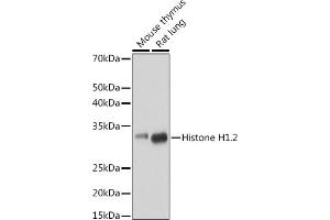 Western blot analysis of extracts of various cell lines, using Histone H1. (HIST1H1C Antikörper)