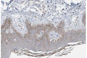 ABIN6266872 at 1/100 staining human Skin tissue sections by IHC-P. (COL14A1 Antikörper  (C-Term))