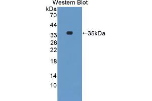 Western blot analysis of the recombinant protein. (STK3 Antikörper  (AA 235-460))
