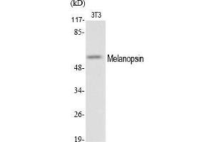 Western Blot analysis of various cells using Melanopsin Polyclonal Antibody. (OPN4 Antikörper  (AA 400-480))