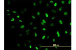 Immunofluorescence of monoclonal antibody to MEIS2 on HeLa cell. (MEIS2 Antikörper  (AA 1-381))