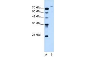 Image no. 1 for anti-Ubiquitin Specific Peptidase 48 (USP48) (AA 171-220) antibody (ABIN205064) (USP48 Antikörper  (AA 171-220))