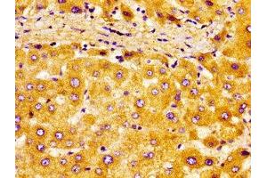Immunohistochemistry (IHC) image for anti-Nuclear Receptor Subfamily 2, Group F, Member 6 (NR2F6) (AA 6-194) antibody (ABIN7161906)
