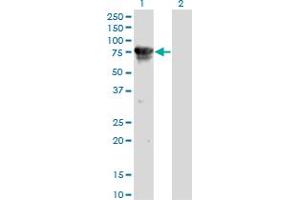 Western Blot analysis of CAMKK2 expression in transfected 293T cell line by CAMKK2 monoclonal antibody (M01), clone 1A11.