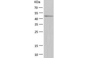 Western Blotting (WB) image for Calcium/calmodulin-Dependent Protein Kinase IV (CAMK4) (AA 1-473) protein (His tag) (ABIN7122095)