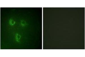 Immunofluorescence analysis of HuvEc cells, using TMEPA Antibody. (TMEPA (AA 101-150) Antikörper)