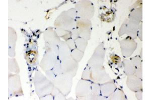Immunohistochemistry (IHC) image for anti-BCL2-Antagonist/killer 1 (BAK1) (AA 22-211) antibody (ABIN3042342)
